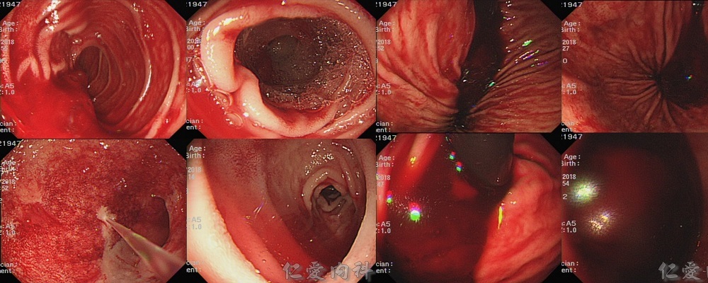 00_Featured_Images - GI-endoscopy-featured.jpg
