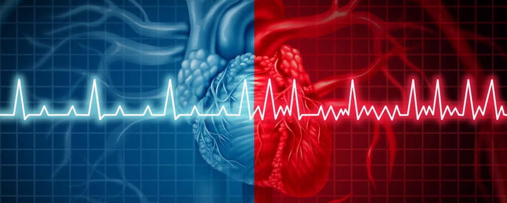 00_Featured_Images - heart-atrial-fibrillation.jpg