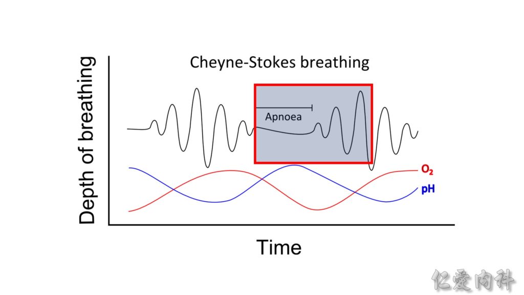 睡覺與呼吸 – Introduction To Obstructive Sleep Apnea