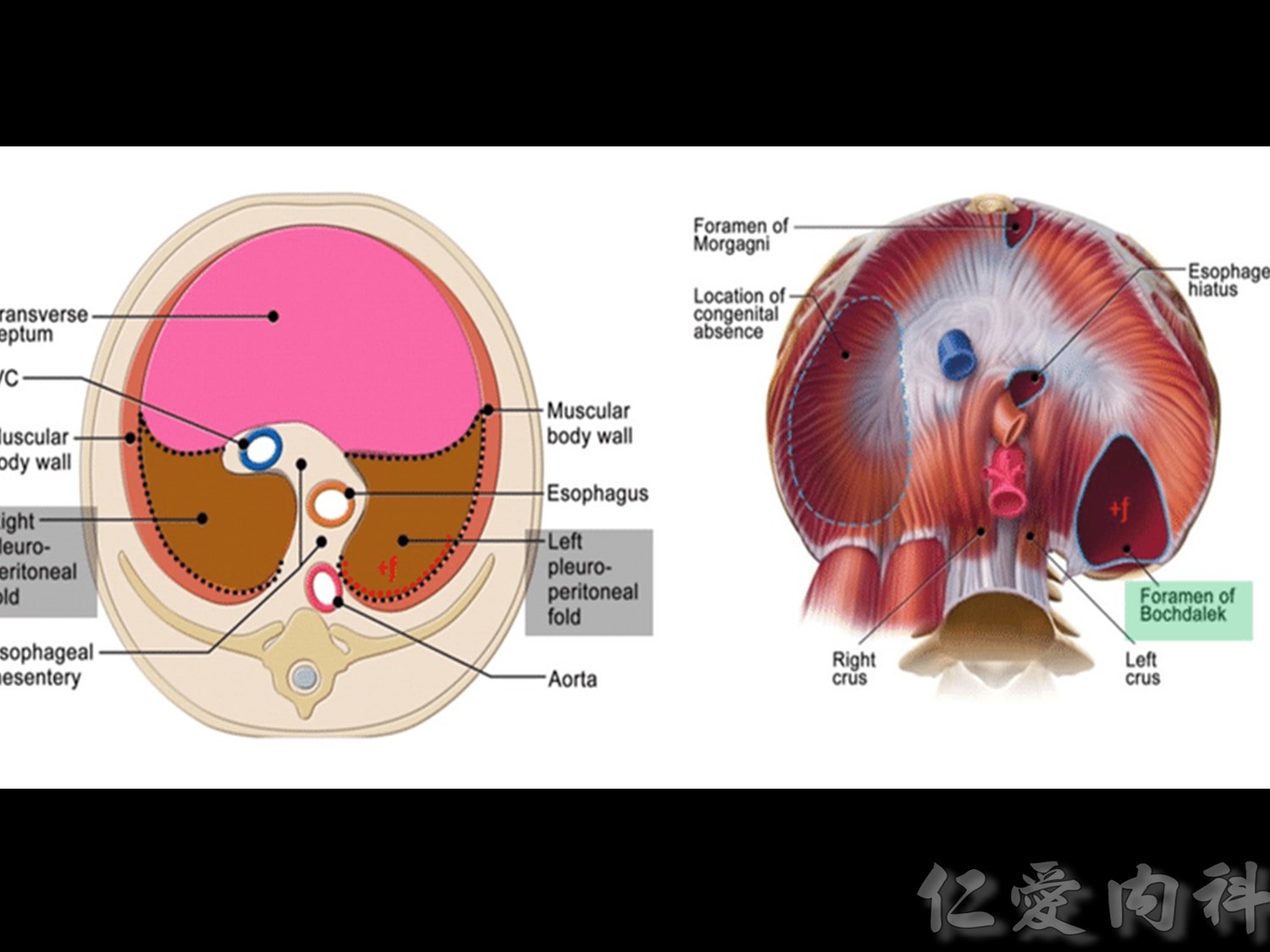 mediastinal_mass - mediastinal_mass-85.jpg